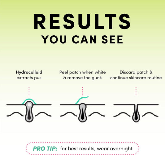 Pimple Patches - Stocking Fillers - Pack of 24 Translucent Hydrocolloid Spot Treatment Stickers for Face - Fast-Acting, Vegan & Cruelty Free - Korean Skin Care