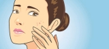 The Best Treatments For Each Type Of Acne Scar