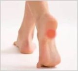 Adelaide Podiatrists Answer Plantar Fasciitis Questions