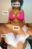 South African woman proudly shows off result of her breast reduction surgery